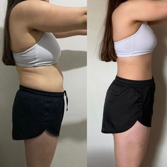 Antes e depois de paciente que perdeu 22 kg